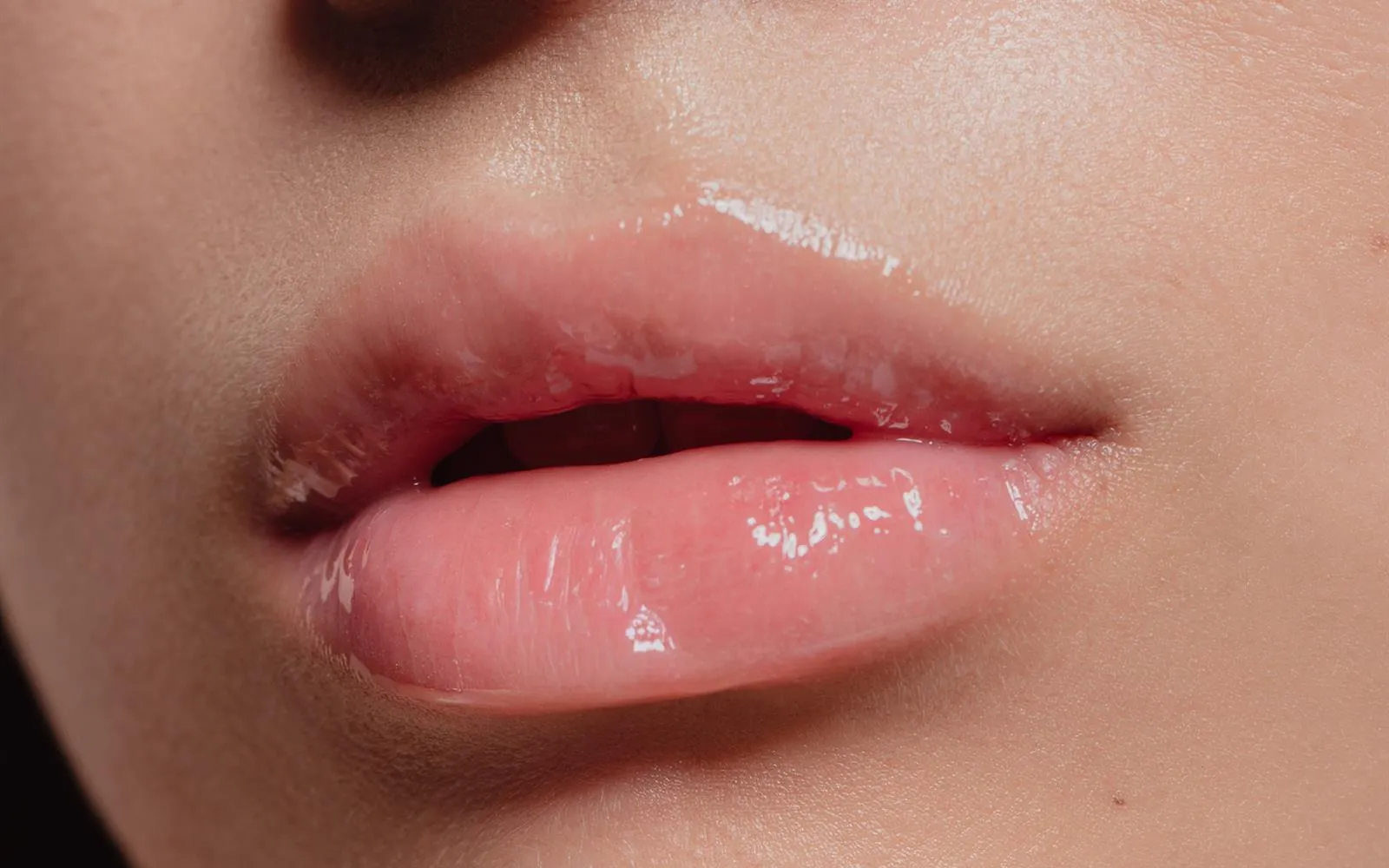 Lip Rejuran HB plus – softer, more hydrated lips without filler volume