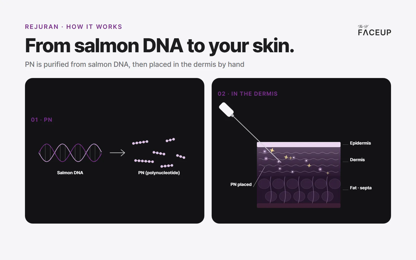 How Rejuran works – PN from salmon DNA placed in the dermis to support skin regeneration